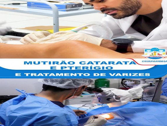 Mutirão de saúde em Chapadinha inicia atendimentos de catarata, pterígio e varizes