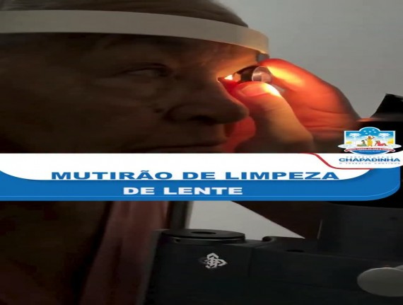 Chapadinha abre cadastro para Mutirão de Limpeza de Lentes a partir de 8 de setembro